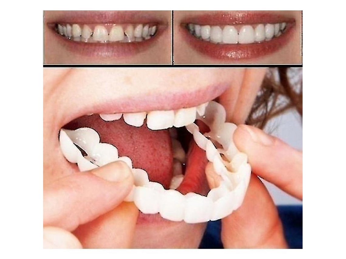Prótesis Dentales Superiores E Inferiores Sonrisa Instantánea Ajuste Cómodo Dientes Cosméticos Flexibles Ryd