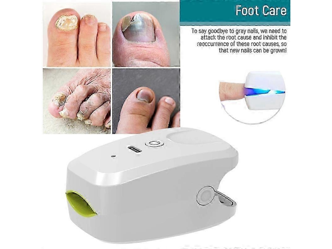 Dispositivo portátil de terapia láser de 905 nm para uñas, indoloro, con revestimiento de silicona antideslizante.